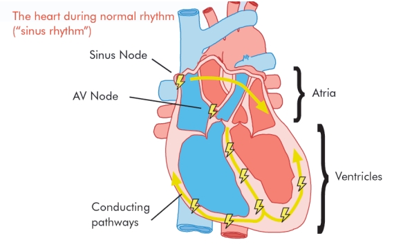 AtrialFib1